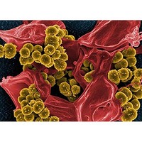 [해외] Photography Poster - Bacteria, Electron Microscope, 24x17.5